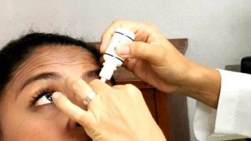 IMSS Yucatán alerta sobre la conjuntivitis y da recomendaciones para&nbsp;prevenirla